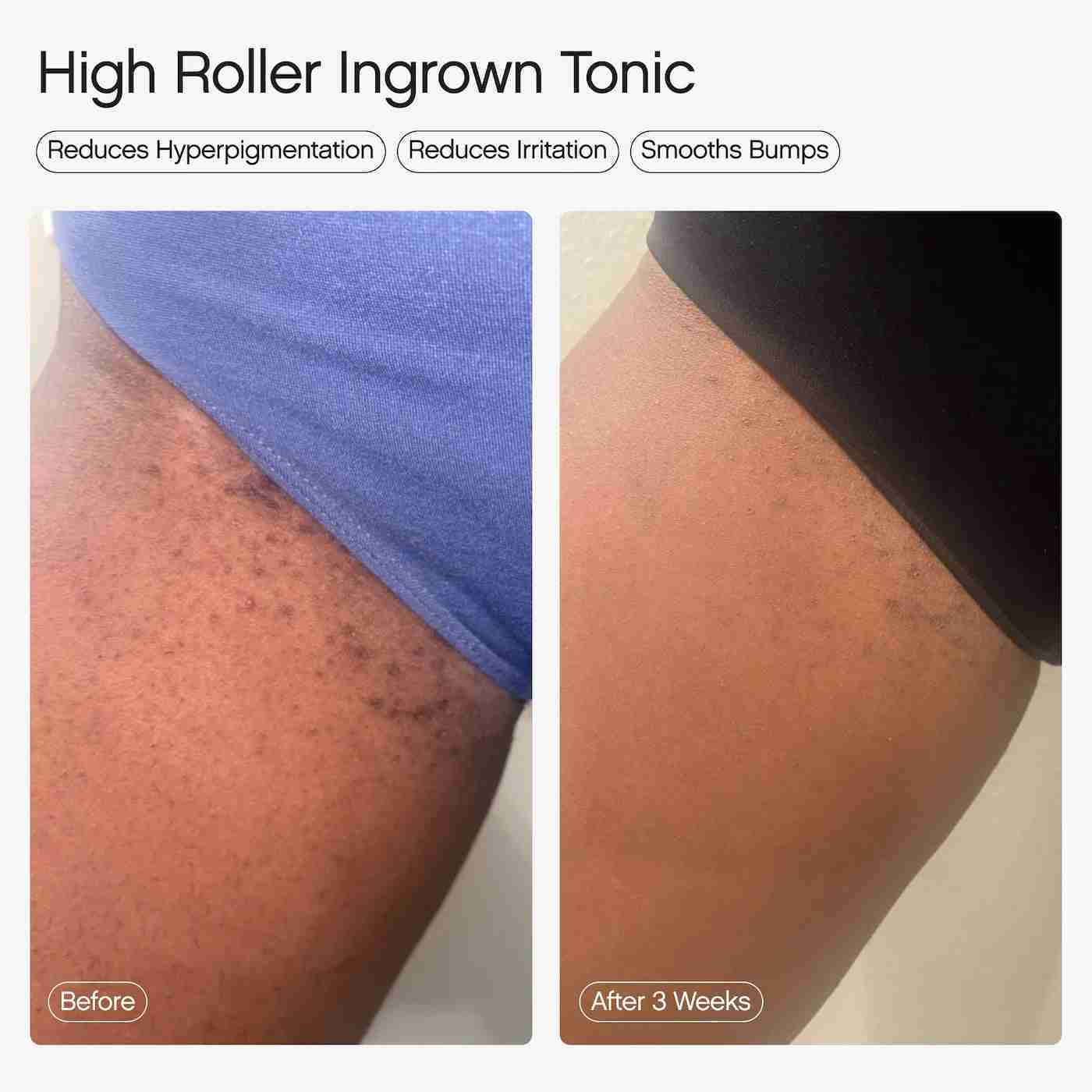 Topicals ingrown hair tonic sample