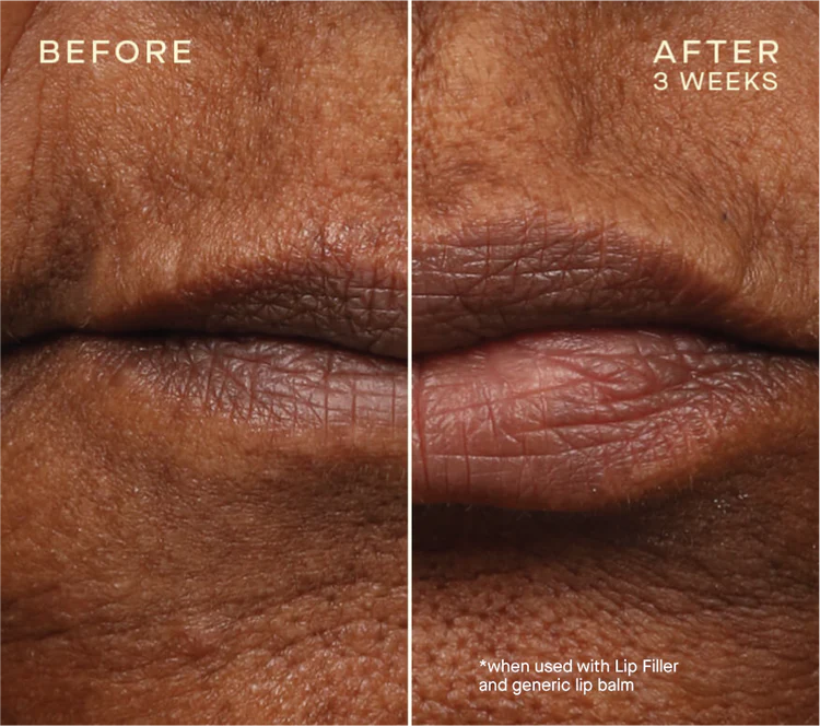 Ourself natural lip filler with plumping hyaluronic acid mini