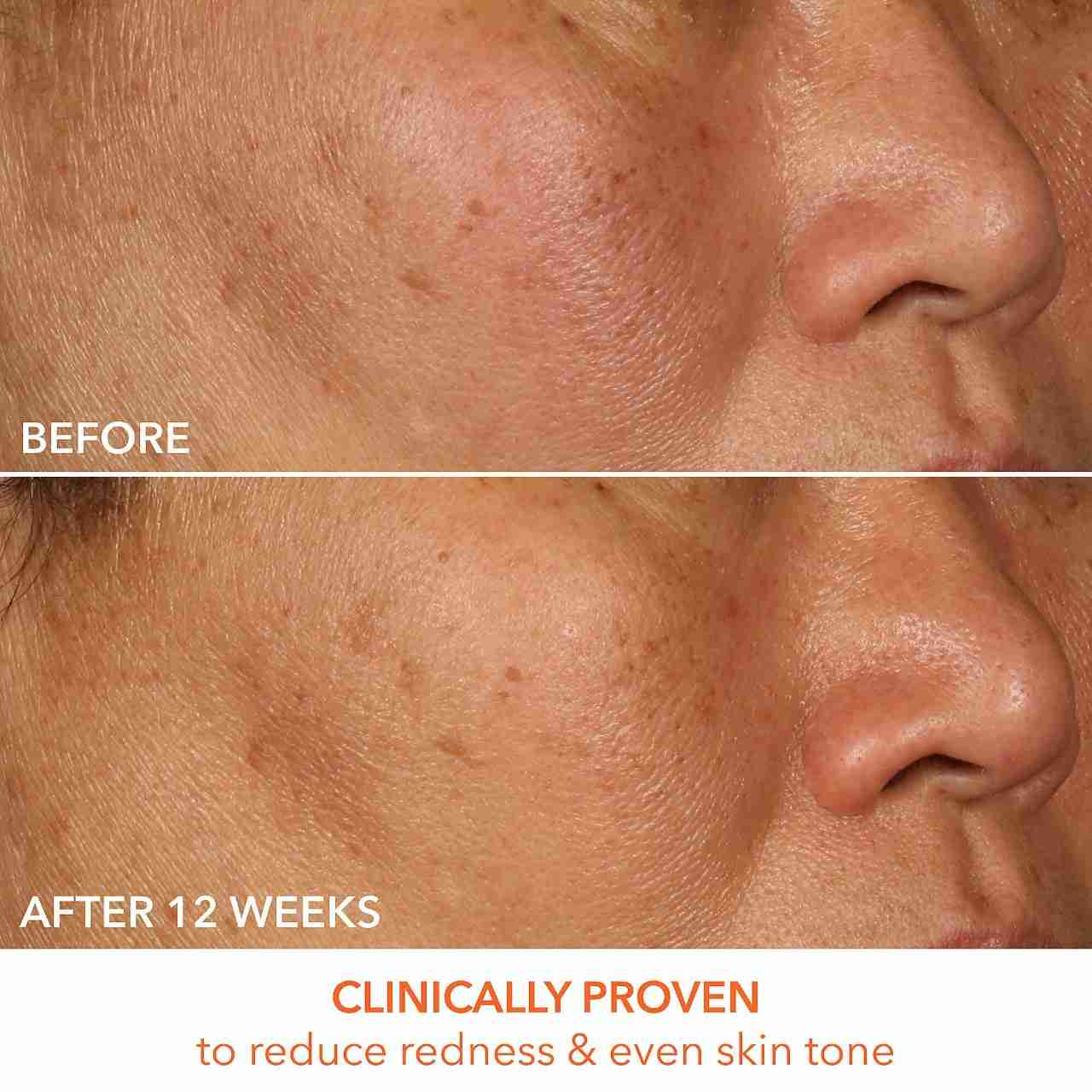 Dr. dennis gross vitamin c lactic acid firming serum sample