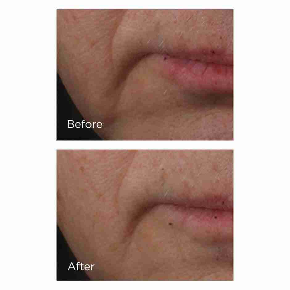 Perricone md cold plasma+ face serum sample