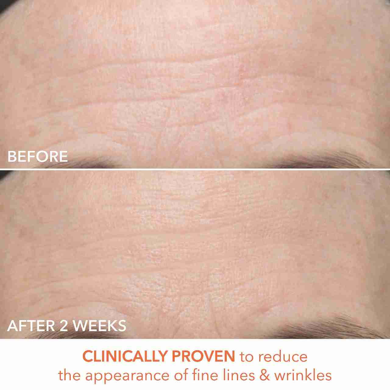 Dr. dennis gross alpha beta ultra gentle daily peel pads