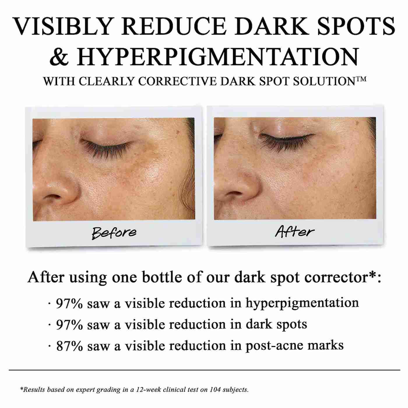 Kiehl's clearly corrective dark spot correcting serum 4ml