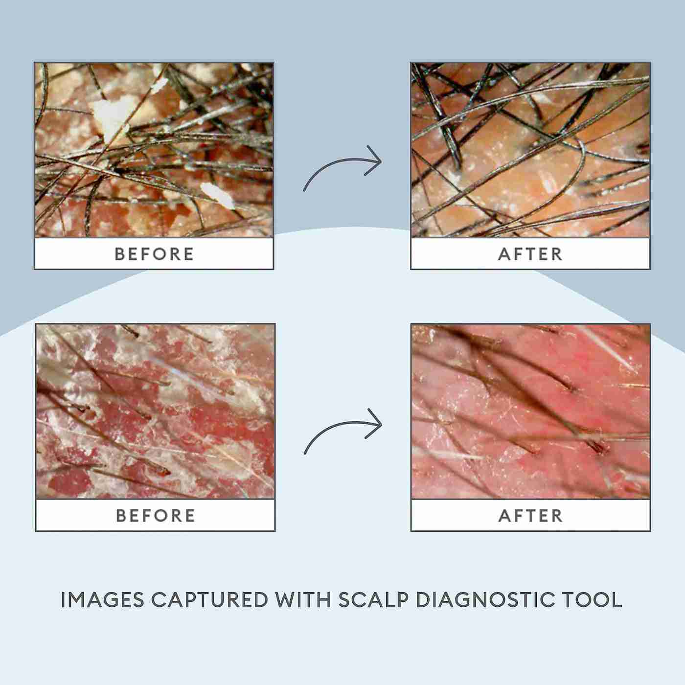 Briogeo scalp revival micro - exfoliating shampoo sample