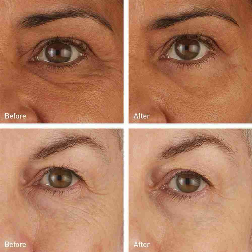 Skyn iceland hydro cool firming eye gels