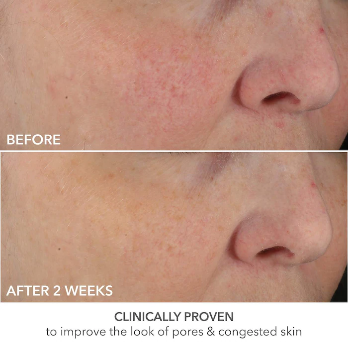 Dr. Dennis Gross Skincare Advanced Retinol + Ferulic Perfectly Dosed Retinol Universal 0.2%